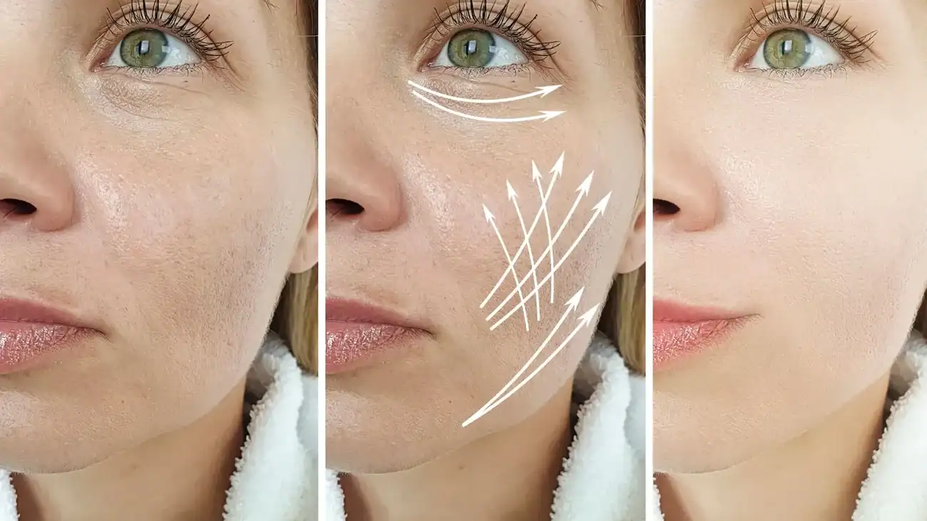 Can One Treatment Really Tackle More Than One Skin Concern Oadby?