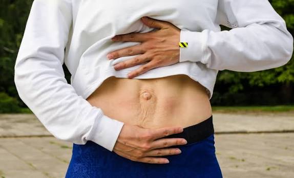 When Could Diastasis Recti Be the Missing Piece of the Puzzle Oadby?